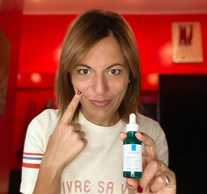 acne-macchie-viso-imperfezioni